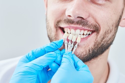 tooth whitening