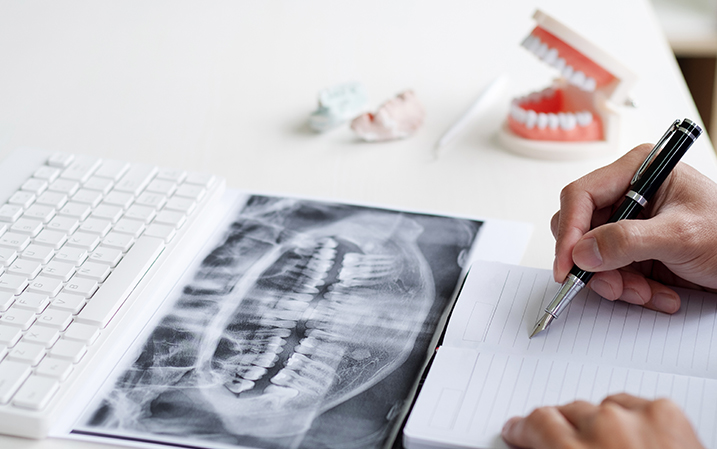 X-ray of a patient's teeth