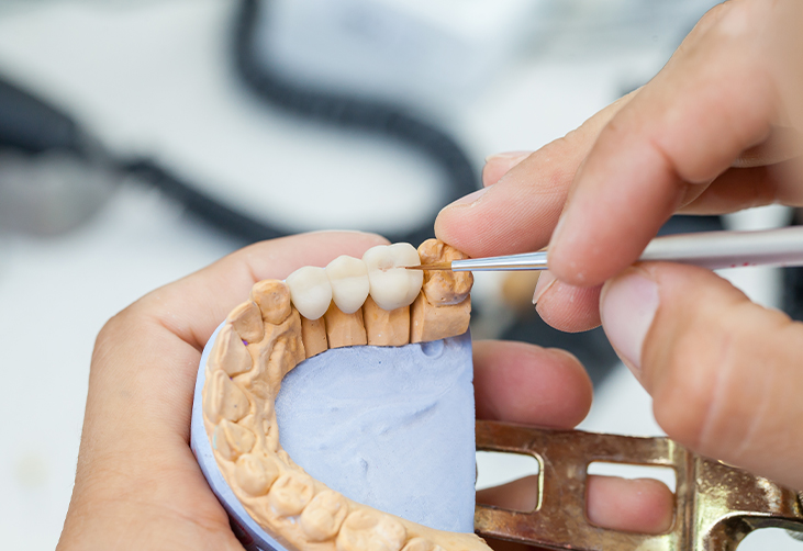 Dentist checking the mold of a patient's teeth