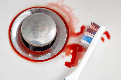 A sink has blood in it with a toothbrush resting in the blood.