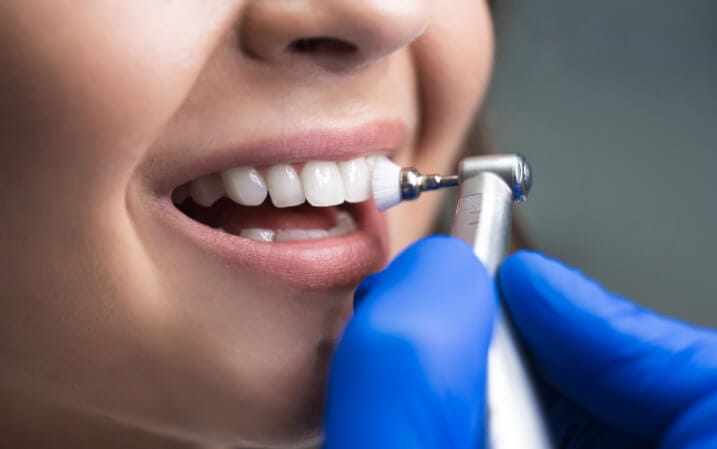 Dentist cleaning a patient's teeth